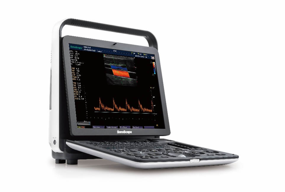 S9 Portable Digital Ultrasound Machine