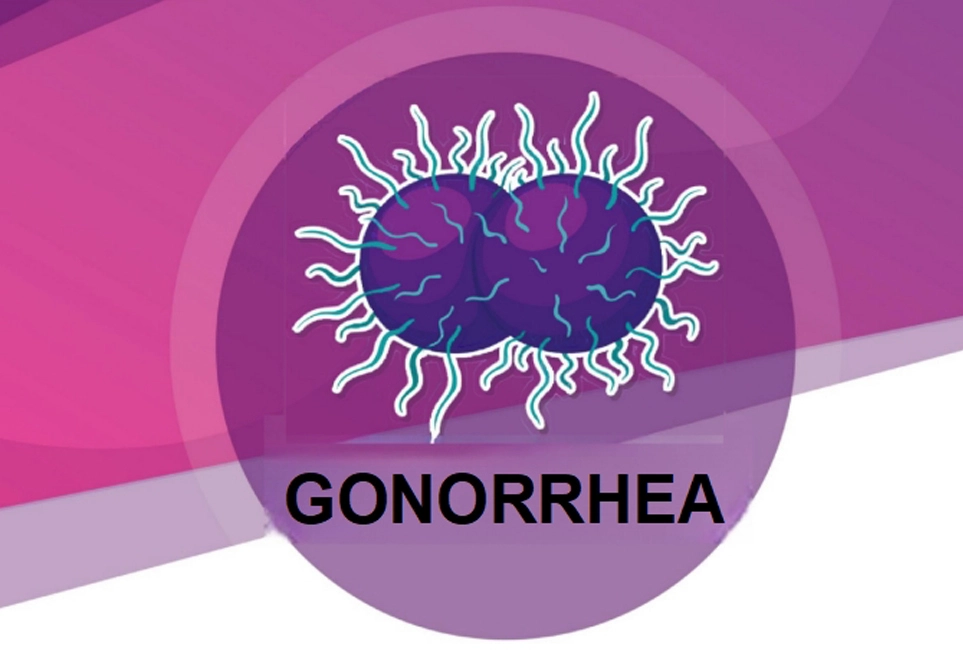 Neisseria Gonorrhoeae Antigen Test Kit  (Colloidal Gold)